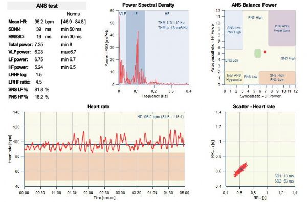 Report grafico PPG-Stress Flow dopo aver effettuato una valutazione del sistema nervoso autonomo // valutazione del sistema nervoso autonomo - Sicilia - Catania, Modica, Caltanissetta e Mussomeli