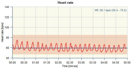 Tecogramma, rappresentazione dela variabilità della frequenza cardiaca // valutazione dei battiti - misurazione HRV - valutazione sistema nervoso autonomo - consulenza psicoterapia Sicilia